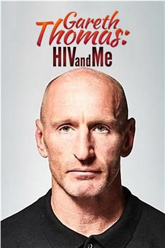 加雷斯·托马斯：HIV与我观看